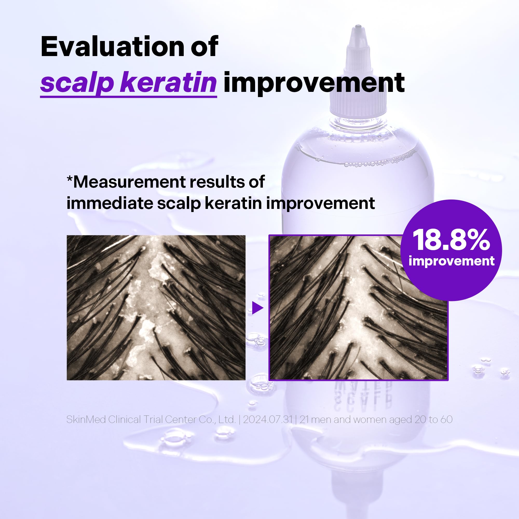 ALIVELAB O2 Scalp Water Shampoo, Water-like Deep Cleansing and Soothing Hair Care for Itchy Sensitive Scalp (11.83 fl.oz)